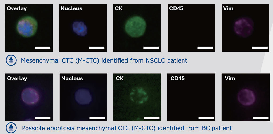 OncoFlux High-Resolution Image
