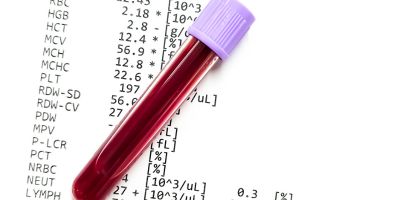 貧血要看哪個指數？帶你了解貧血指數，讓健康管理更好掌握！